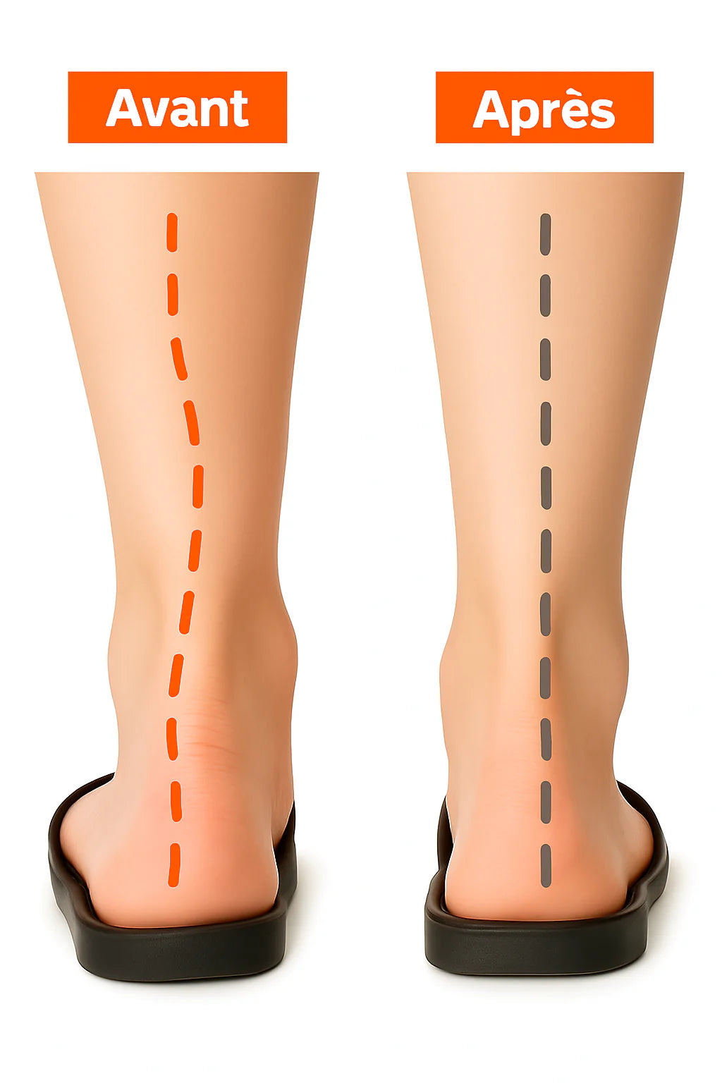 فرشة طبية داعمة للقدم semelle orthopédique